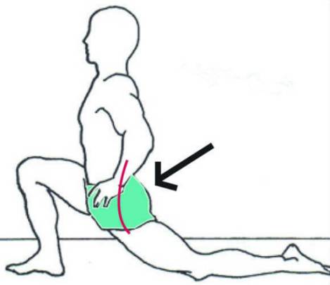 怎么判断是不是骨盆前倾矫正方法,矫正骨盆前倾的睡觉姿势