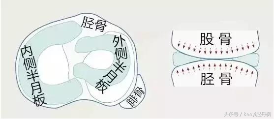 膝关节疼痛如何预防和干预,膝盖常见伤病症状