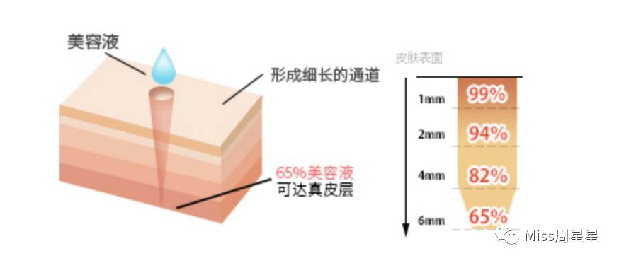 嫩肤提拉控油美容仪,淡斑嫩肤提拉美容仪