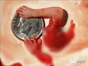 无痛人流3次会不孕吗,无痛人流花了快6千感觉被骗了