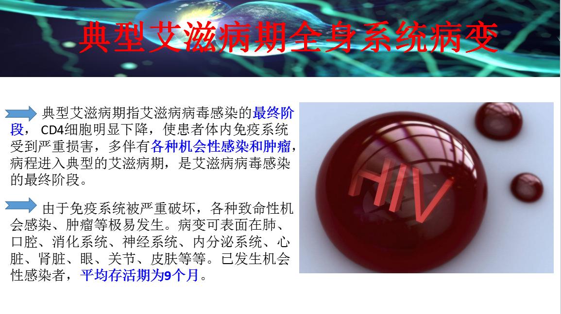 “伪装大师”艾滋病有哪些神经系统表现？头疼脑热不要轻易放过！