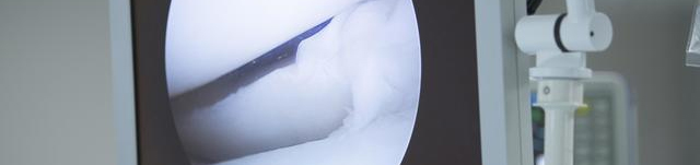 关节镜手术治疗半月板效果怎么样,关节镜手术需要几天能出院