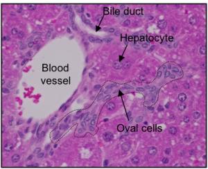 间充质干细胞治疗肝病的最新消息,干细胞治肝癌症靠谱吗