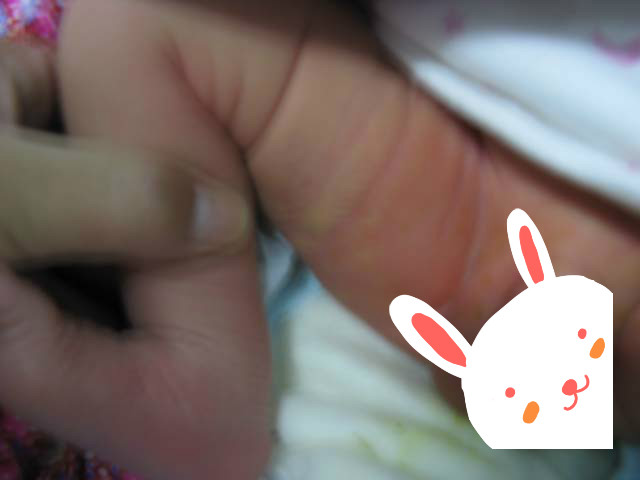 初生宝宝照蓝光十小时未归，见面的那一刻我哭了！