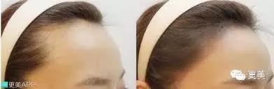 韩式半永久,韩式半永久都有什么