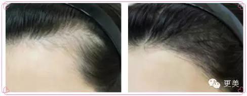 韩式半永久,韩式半永久都有什么