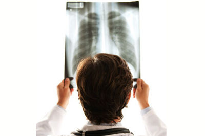 做饭注意防肺癌,厨房油烟成女性肺癌的罪魁祸首