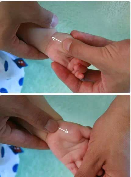 小儿推拿教程带视频的书,小儿推拿止咳化痰手法图解