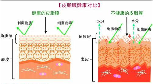 怎么去脸部*血丝红**-敏感肌修复瑞玲老师8000肤诊案例连载009