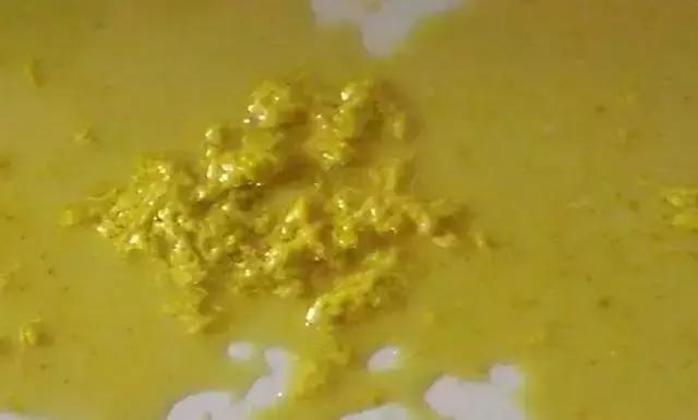 拉黄色便和黑色便是什么原因,黑绿色稀便是什么原因