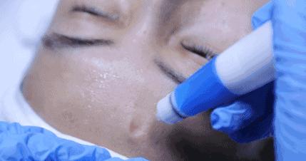 苏州韩氏皮肤管理,苏州面部皮肤管理推荐