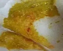 拉黄色便和黑色便是什么原因,黑绿色稀便是什么原因