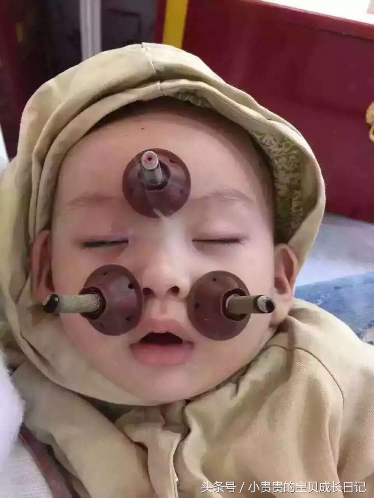 宝宝一直流鼻涕怎麽办？妈妈必看简单的7个方法