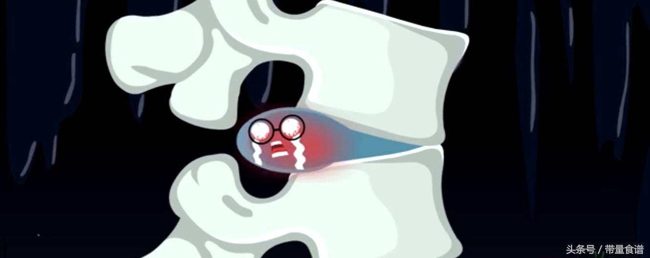 坐不久站不久用什么治疗,刚刚腰椎间盘突出怎么办