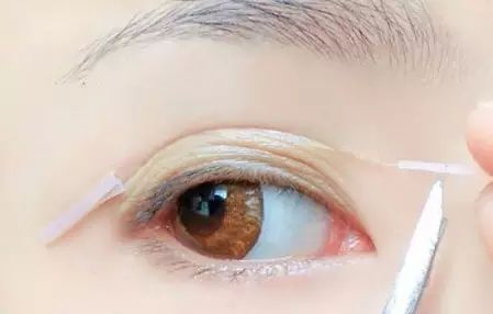 肿眼泡双眼皮贴正确的贴法,蕾丝双眼皮贴正确的贴法
