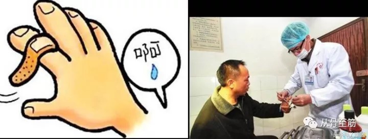 伤口换药越勤越好吗,伤口换药还是好疼