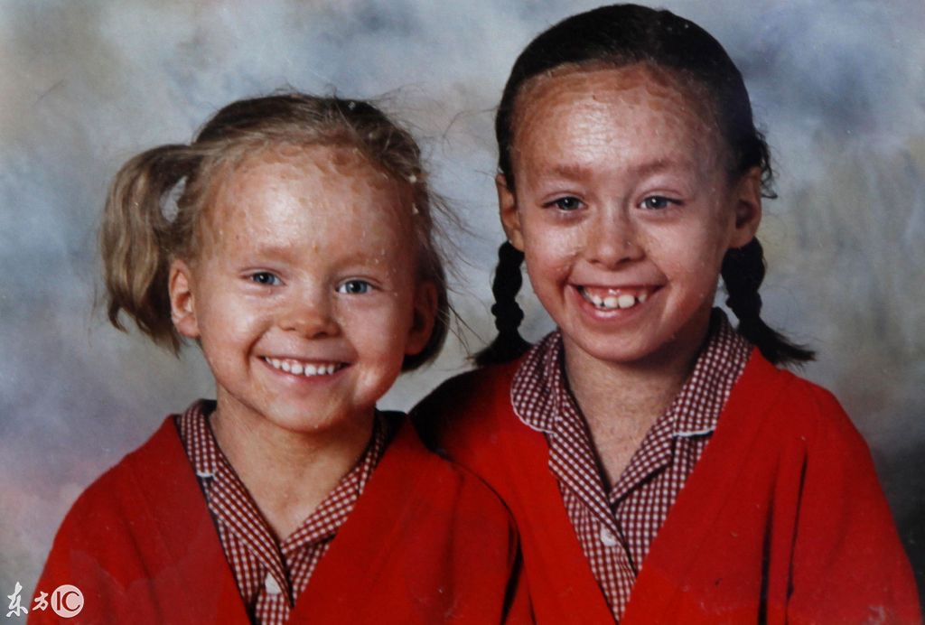 姐妹俩都患有癌症,姐妹两同时生病