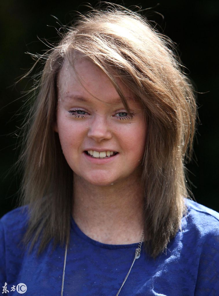 姐妹俩都患有癌症,姐妹两同时生病