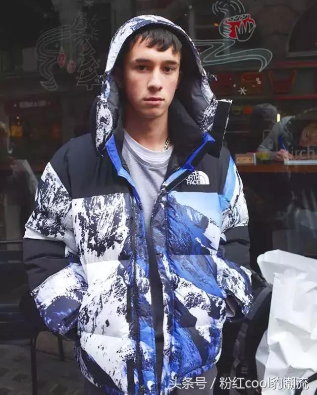 齐刘海发际线后移怎么做造型,齐刘海脱发严重怎么处理