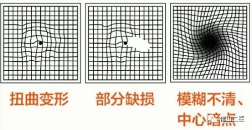 眼健康调理,眼健康调理手法视频