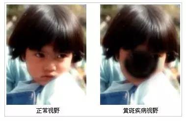 眼健康调理,眼健康调理手法视频