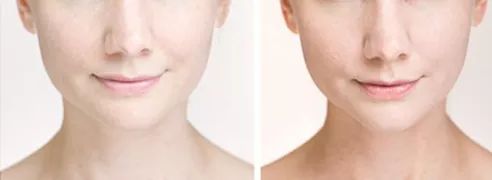 十斤红糖不如一口铁元,拯救黄脸婆全靠它了