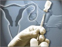 hpv70型阳性怀孕,hpv阳性还能怀孕吗男性