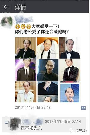 男生防止发际线后移的方法,男性怎样防止发际线后移