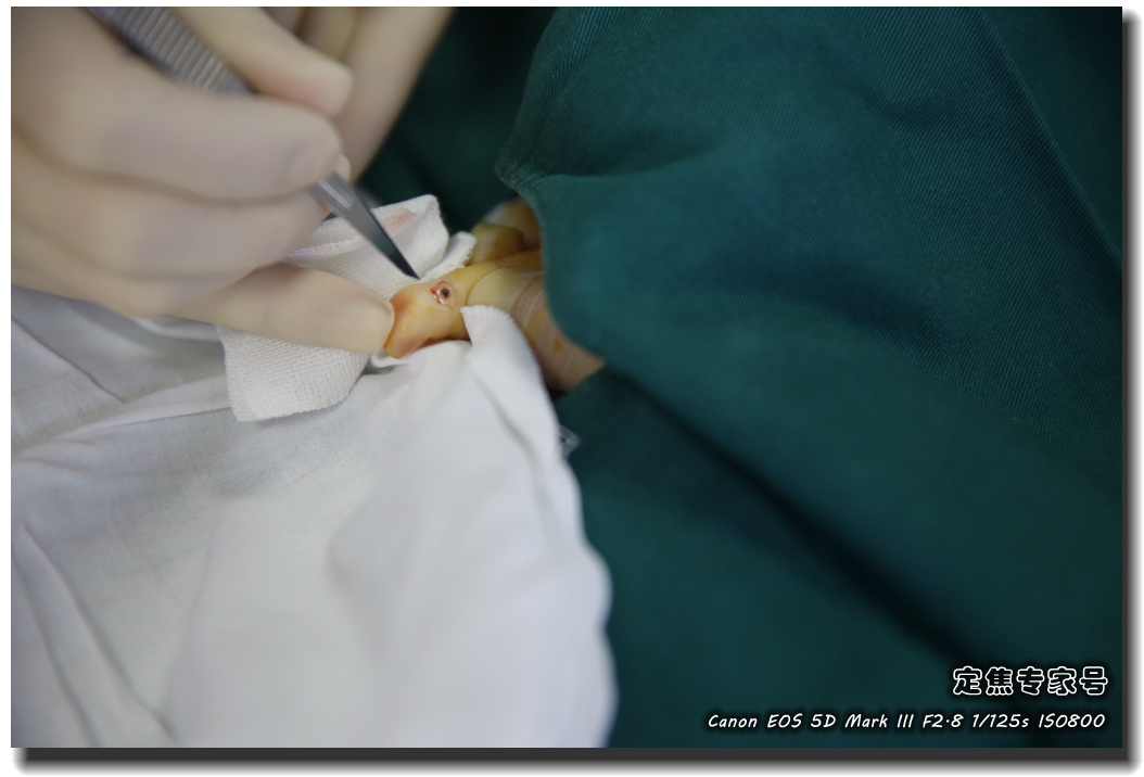 皮肤专家诊室故事连载之五,手心和眉心“开天眼”?