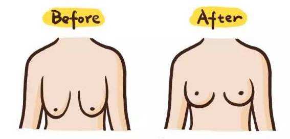 急性乳腺炎导致乳腺剧痛怎么办,乳腺炎涨奶