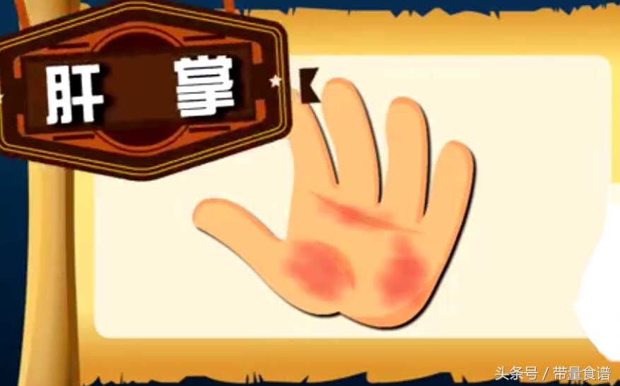 小三阳和大三阳报告单都是数字,认识乙肝视频