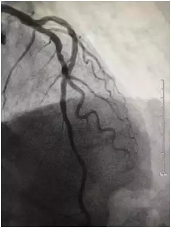 一天抢救两次,一天抢救两次还有救吗