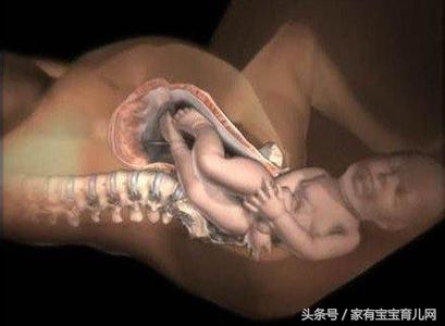 先见红和先破水都是什么样的,先见红和先破水取决于什么