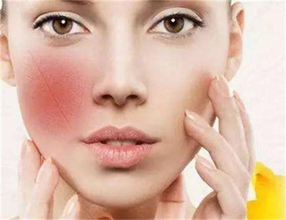 补水时脸上会有刺痛的感觉怎么办,贴补水面膜脸上刺痛是怎么回事