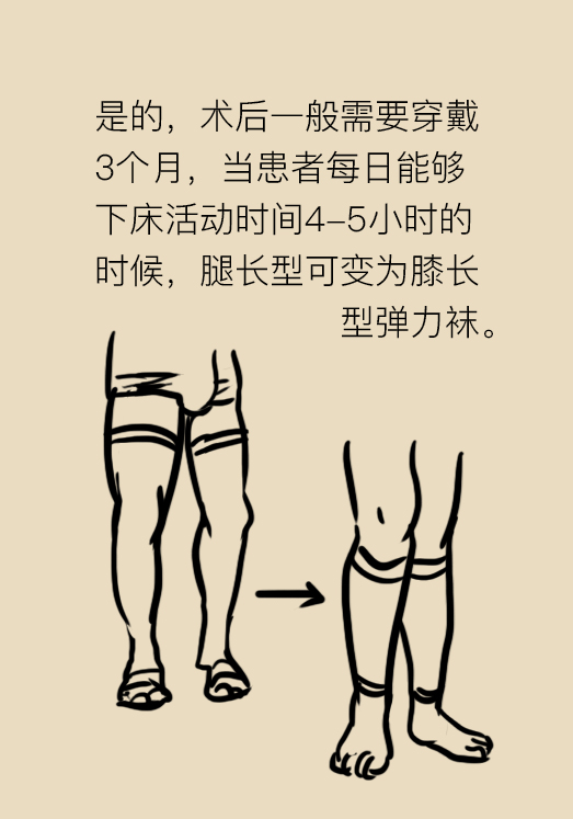 弹力袜对下肢血栓有什么帮助,预防下肢静脉血栓弹力袜注意事项