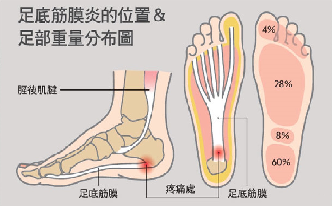 奥运会运动员扭伤用药,奥运会运动员康复训练
