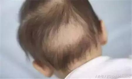 宝贝头发又少又黄,儿童头发少怎么办教你一招