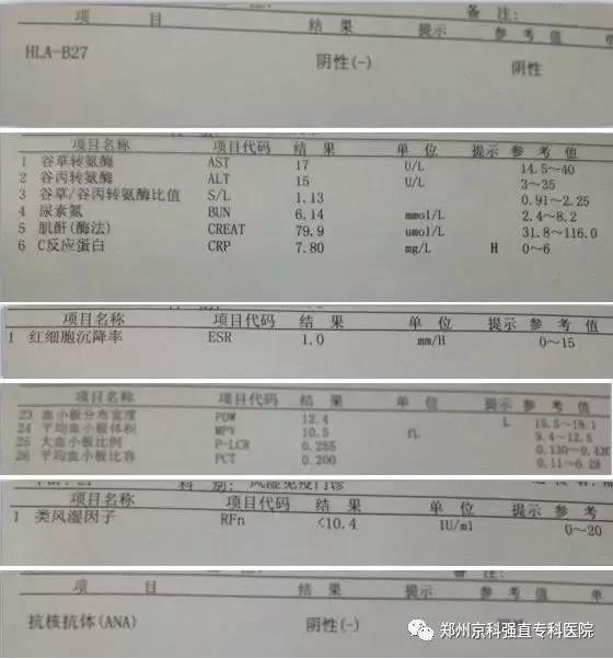 强直性脊柱炎需要做什么检查确诊,强直性脊柱炎要做什么检查确诊