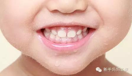 小朋友如何预防口腔疾病,如何帮小孩子克服治疗牙齿的恐惧