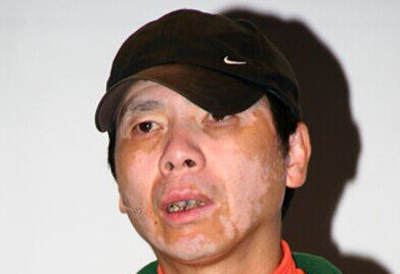 刘德华鲁豫说受伤,刘德华张韶涵现状