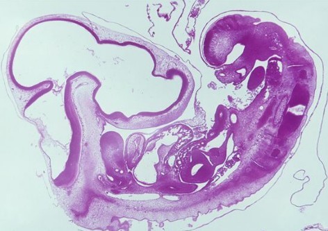 孕期羊水过多或过少的原因有哪些,羊水太少胎儿会怎么办