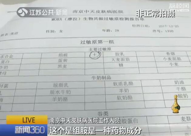 过敏原检测用抽血还是皮试,儿童过敏原检测做皮试还是抽血