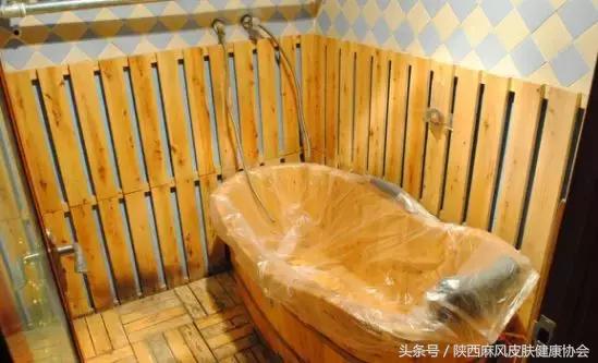 银屑病皮肤病患者,皮肤病银屑病患者