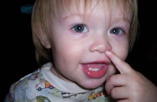 小孩鼻子被鼻屎塞住最快解决方法,冬季小孩干鼻屎堵住能天天清理吗