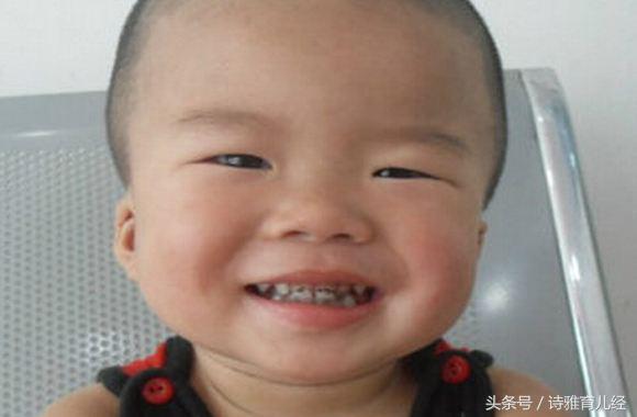 宝宝牙齿上有黑点是蛀牙吗,宝宝牙齿上有小黑点是蛀牙吗