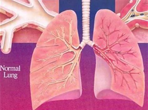 嗜酸性粒细胞支气管炎可以跑步吗,嗜酸性粒细胞支气管炎锻炼方法