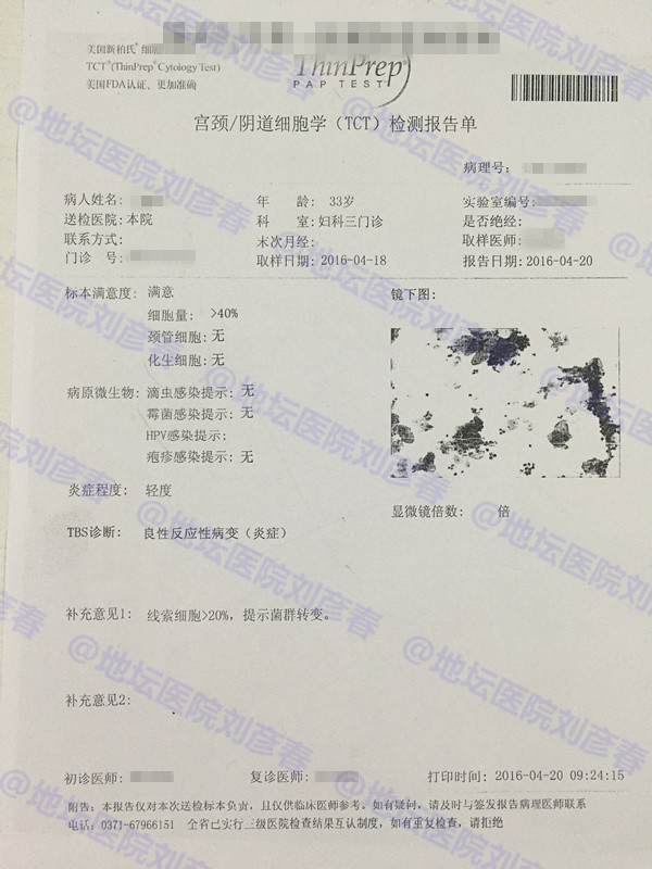 宫颈锥切后新感染hpv53型,宫颈活检低度病变hpv感染