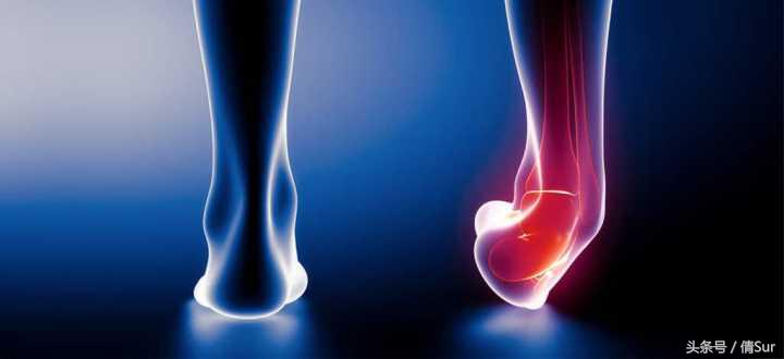 怎么避免脚踝习惯性扭伤,儿童脚踝反复扭伤