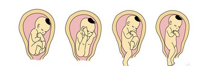 怀孕30周胎位不正头朝上怎么办,过了32周孕妇胎位还能调整吗