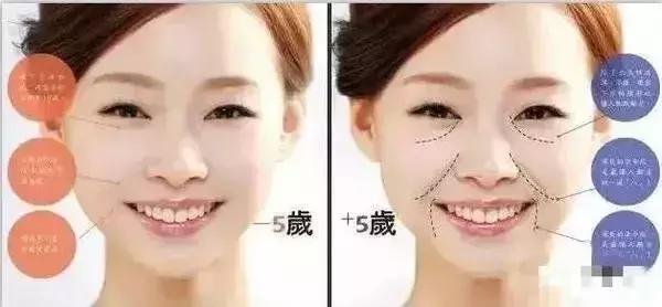 做完线雕真的会年轻吗,经常做线雕面部会年轻吗
